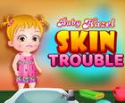 Baby Hazel Skin Trouble