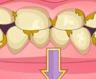 Loše Zube Preuređenje