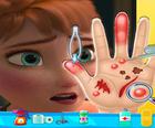 Anna frozen Hand Doctor: Linksmi žaidimai mergaitėms Onlin