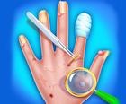 हाथ की त्वचा डॉक्टर-अस्पताल खेल