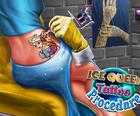 Процедура татуировки Ледяной королевы